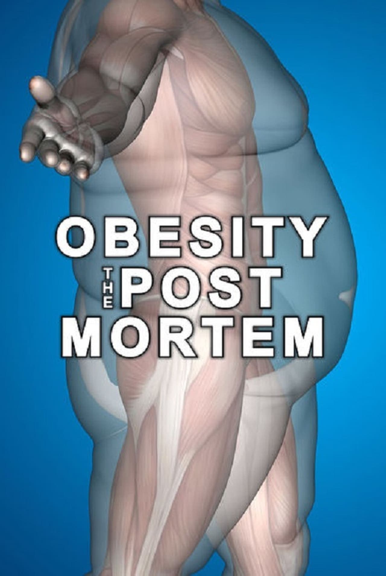 Película Obesity: The Post Mortem