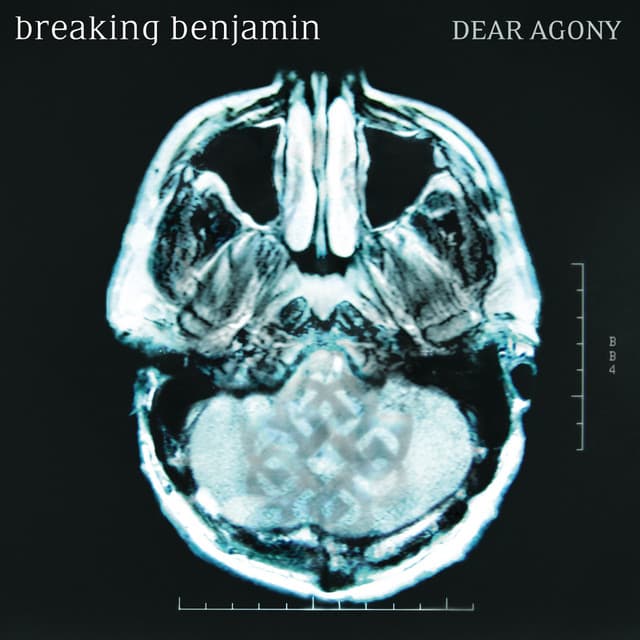 Canción Dear Agony