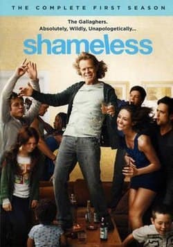 Serie Shameless