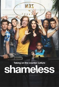 Serie Shameless