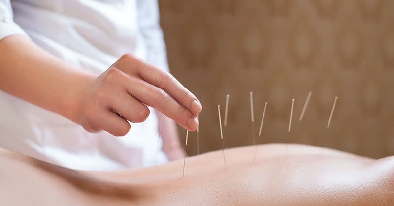 Fashion Acupunctura | Clinica Tâmara Castelo | Lisboa