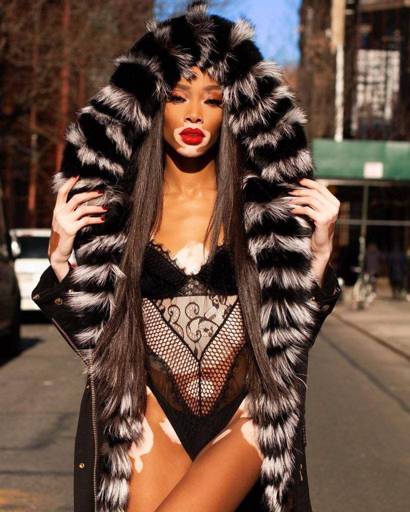 Fashion Winnie Harlow