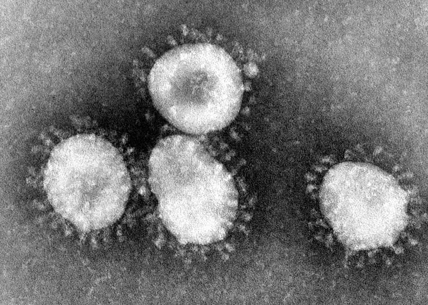 Product Coronavirus 