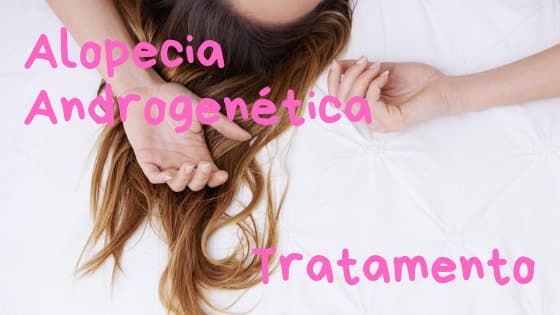 Moda Alopécia androgenética: Tratamento - Couro e Cabelo