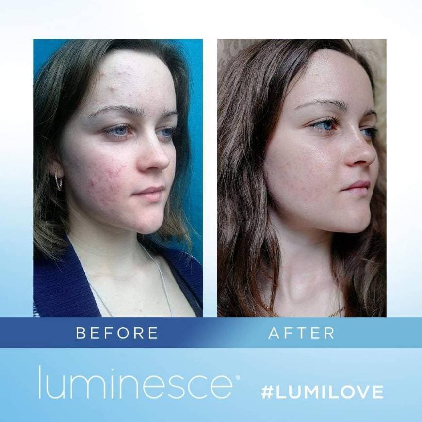 Fashion Kit luminesce - Junesse