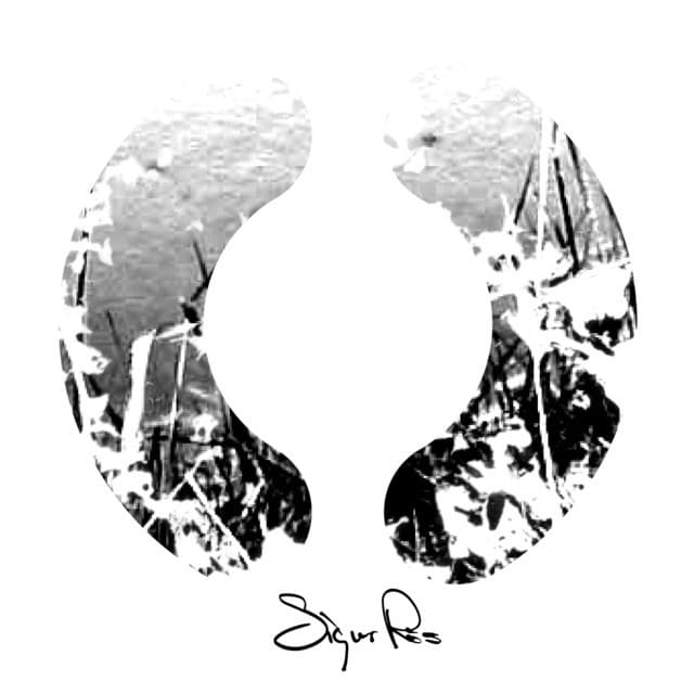 Music Sigur 3 (Untitled)