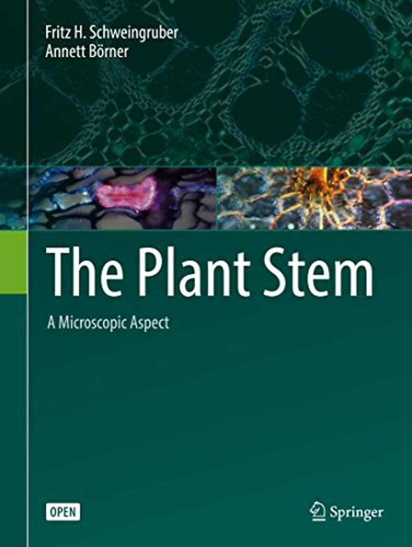 Producto The Plant Stem: A Microscopic Aspect