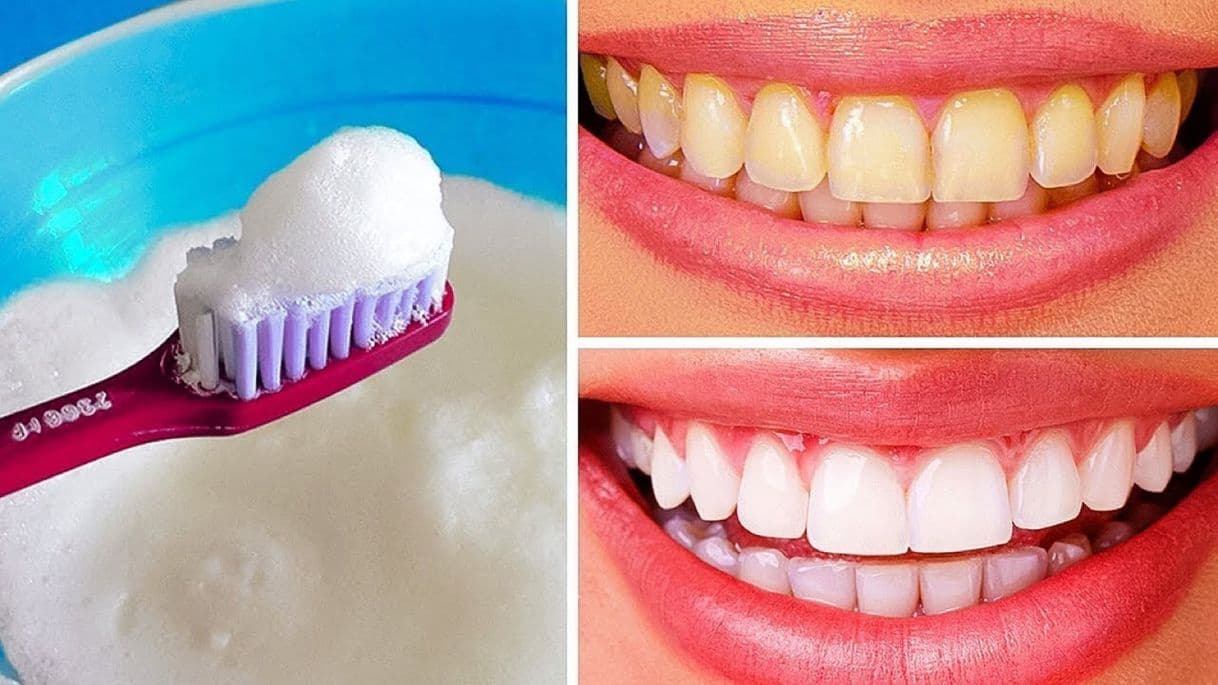 Fashion Como Blanquear Los Dientes De Forma Natural