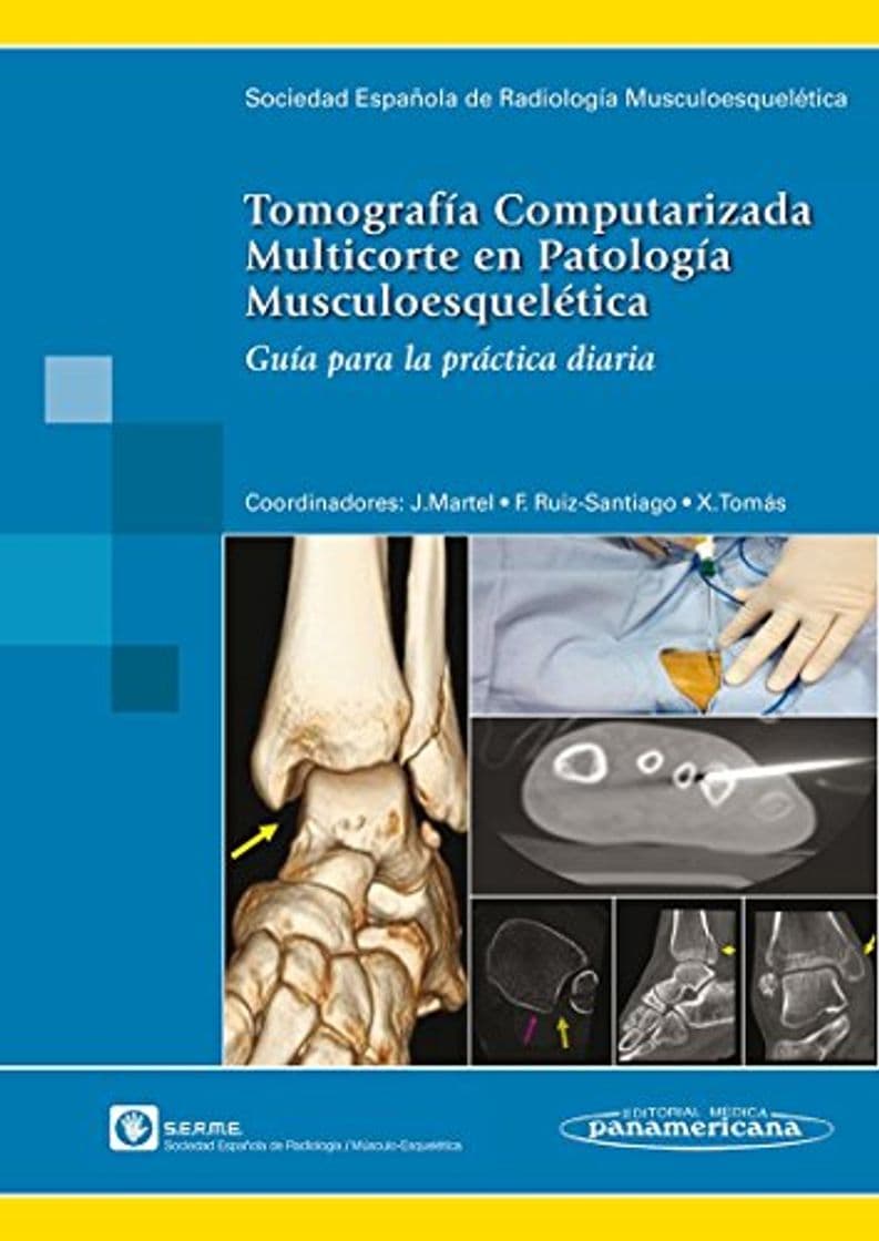 Producto Tomografía Computarizada Multicorte en Patología Musculoesquelética