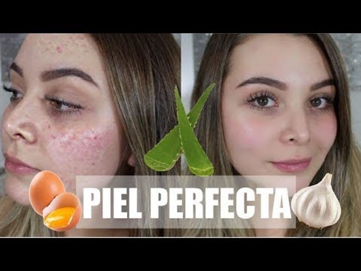 Fashion Remedios Naturales para una Piel Perfecta SIN ACNE!