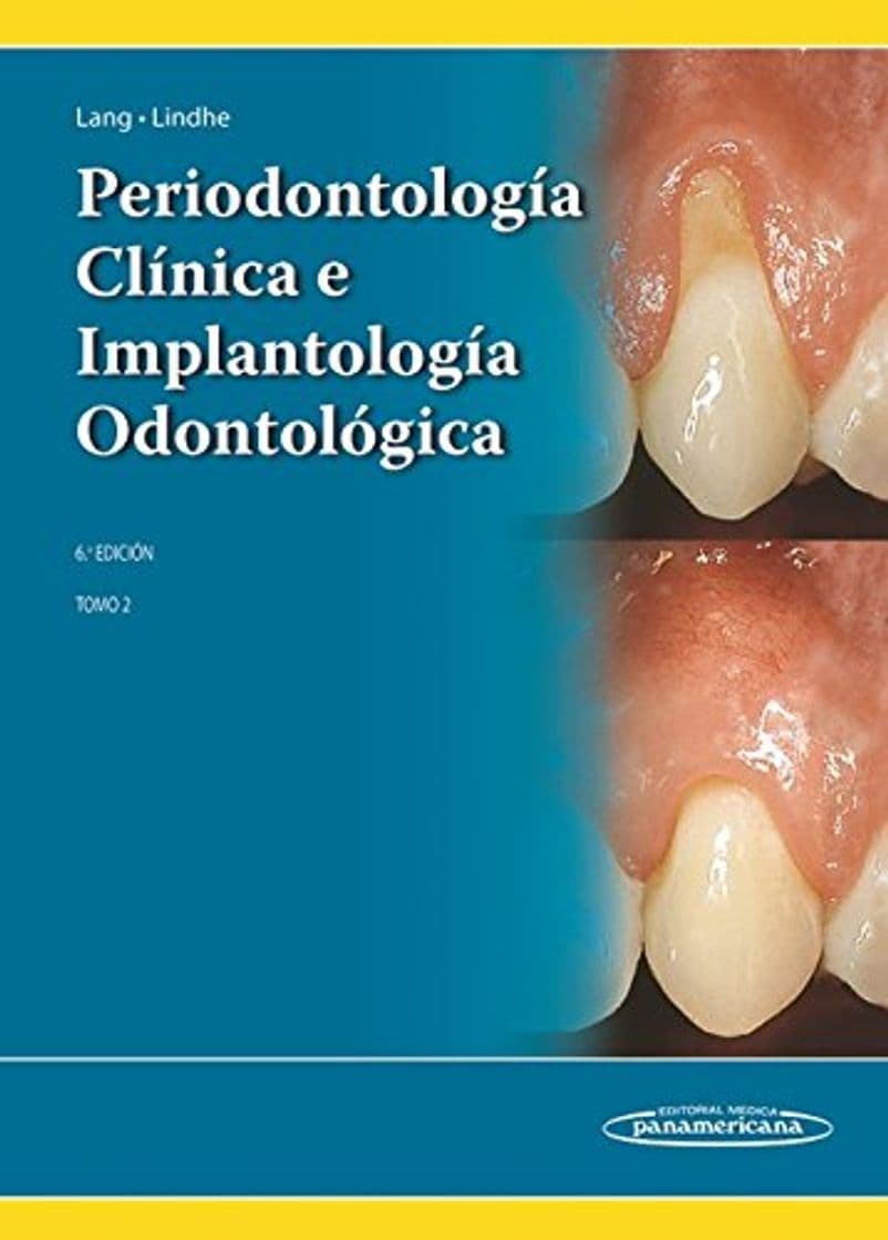 Libro Periodontología Clínica e Implantología Odontológica