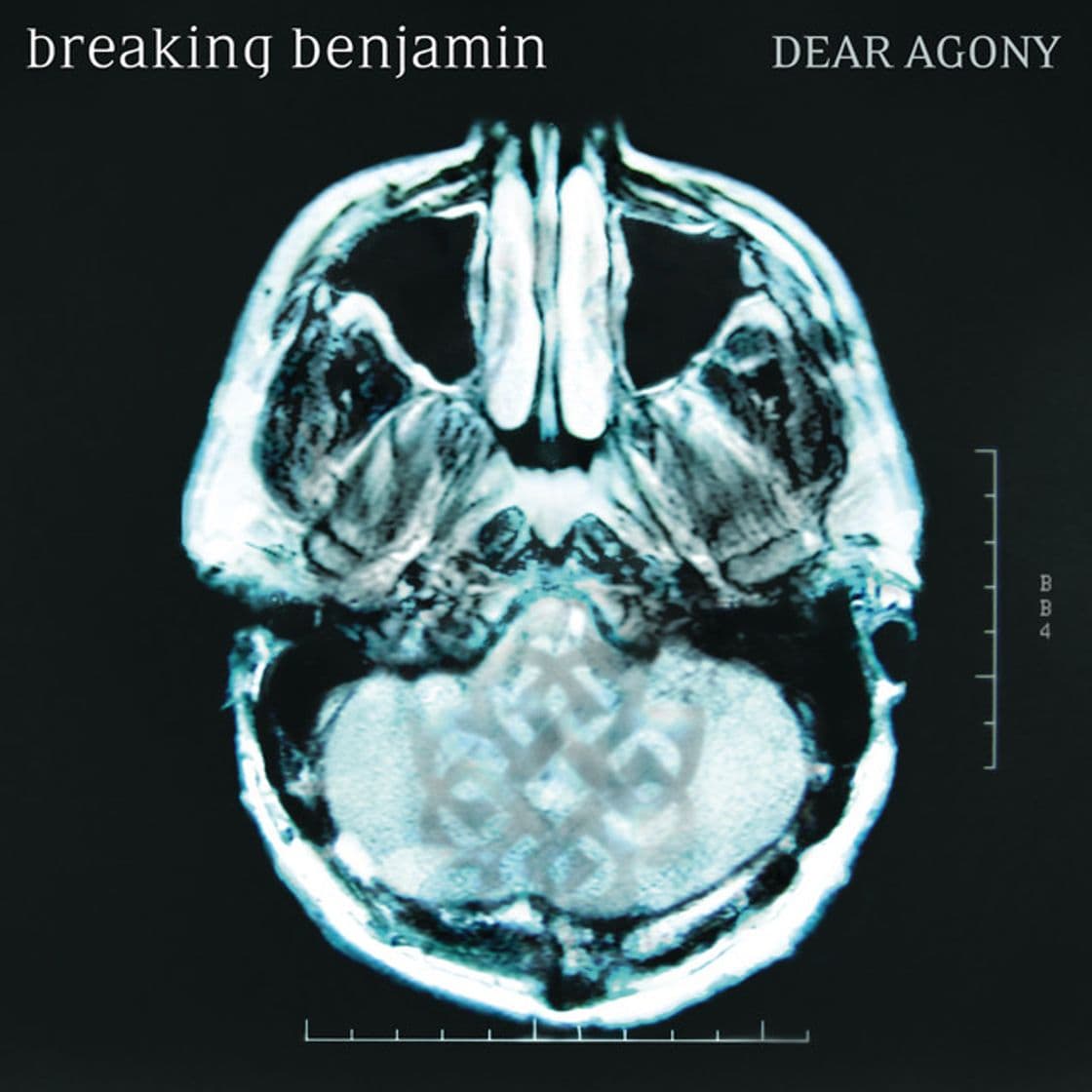 Canción Dear Agony