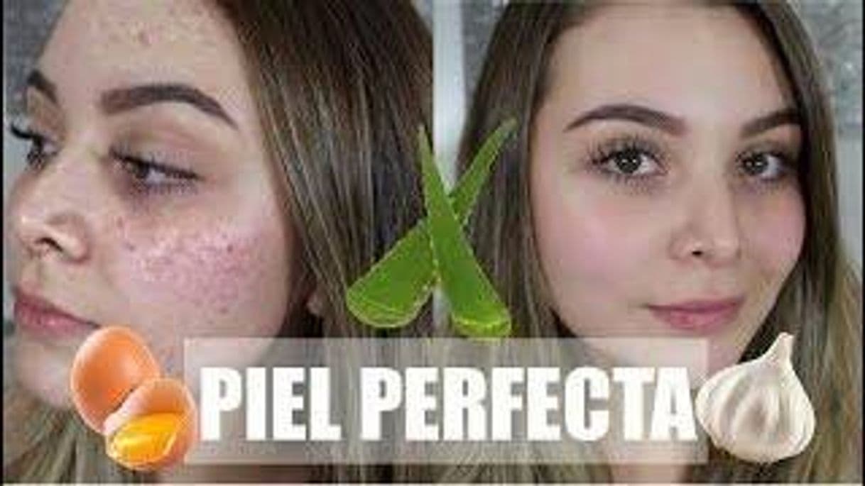 Moda Remedios Naturales para una Piel Perfecta SIN ACNE! - Maqui0