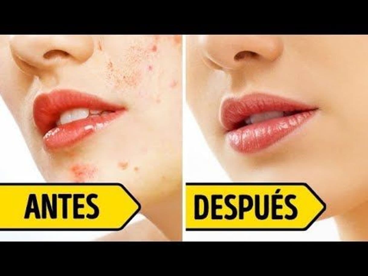 Fashion 8 Beneficios de hielo que los doctores nunca te dijeron