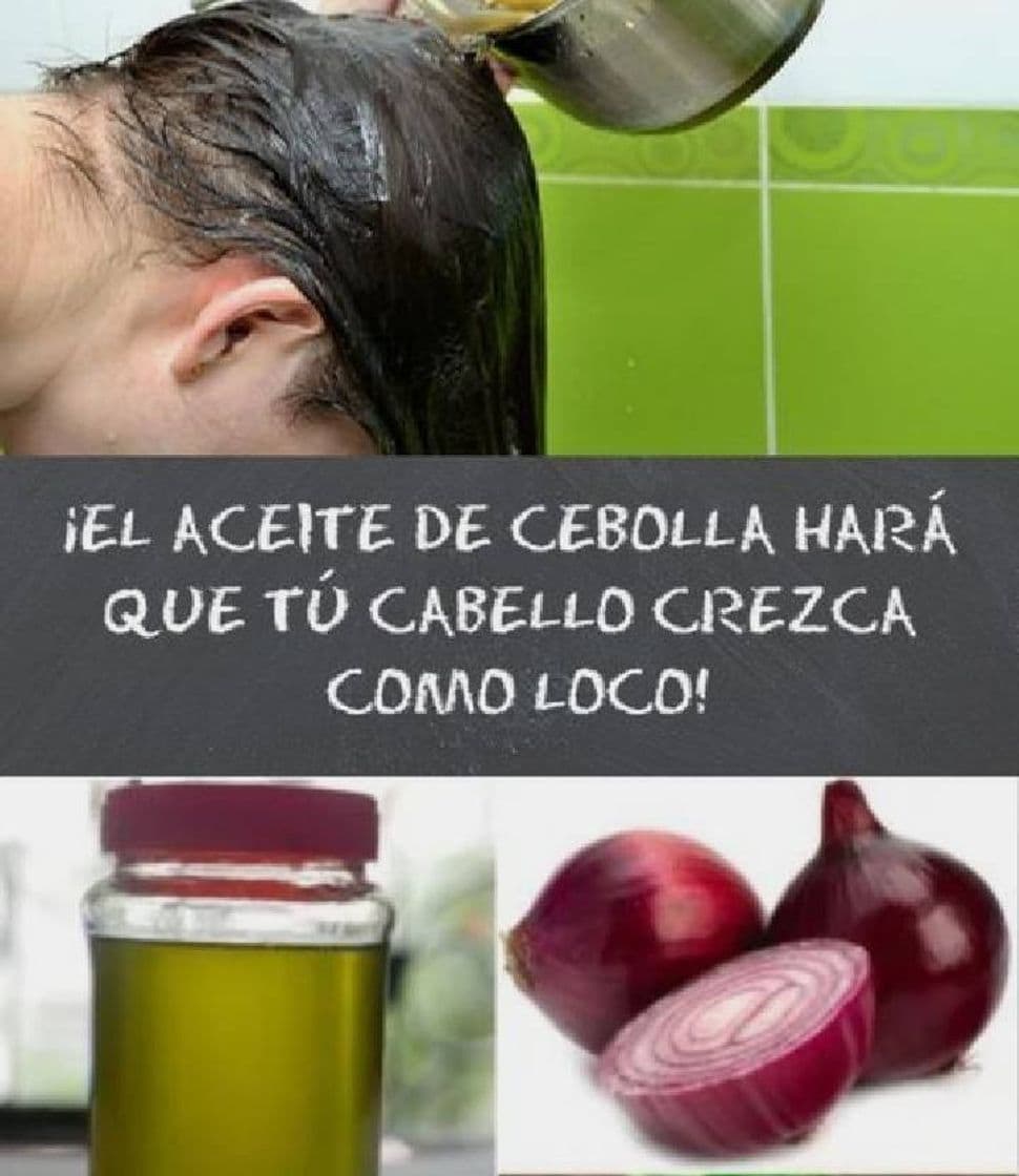 Fashion Aceite de cebolla para el crecimiento del cabello