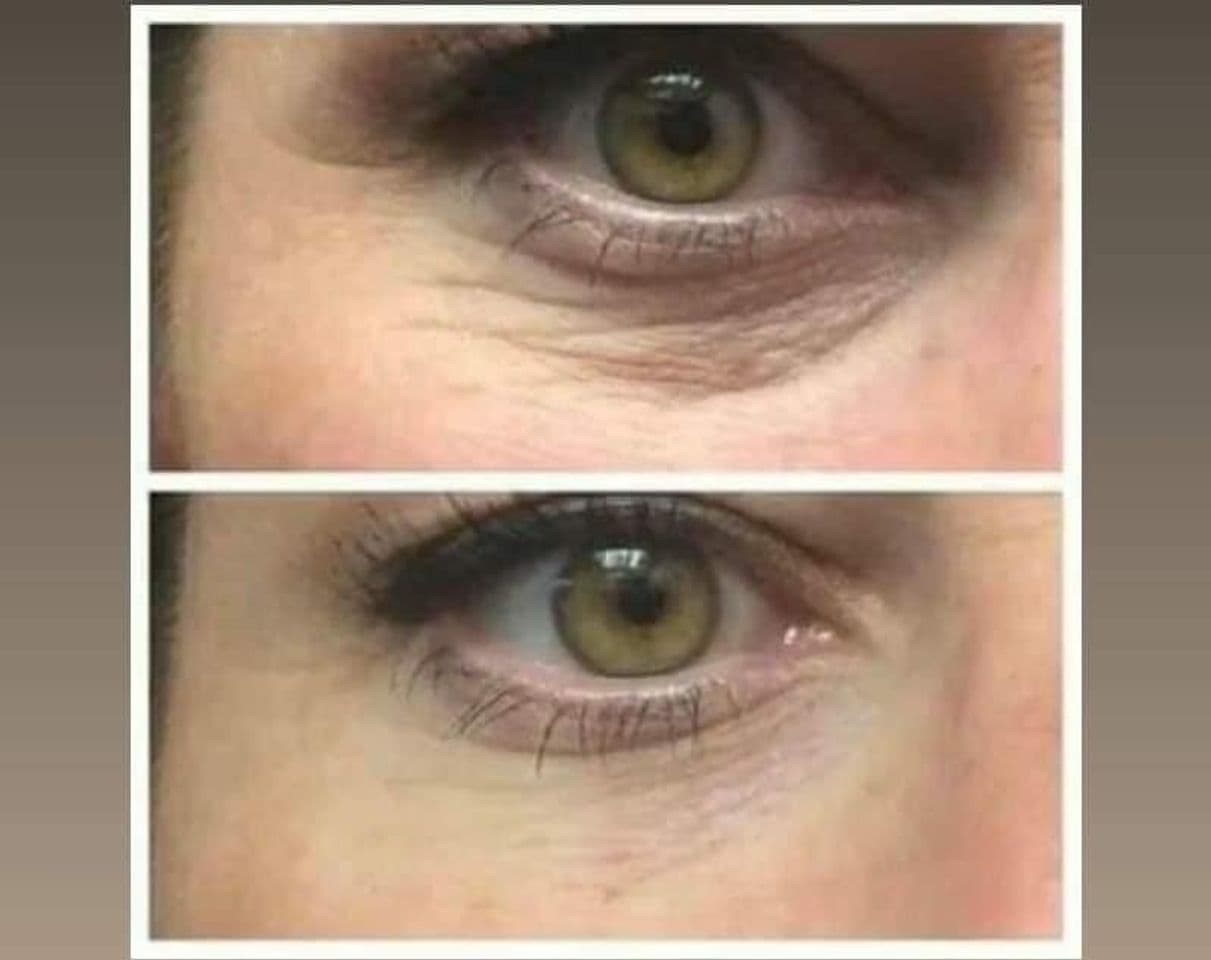 Fashion Neora suero de Ojos efecto botox