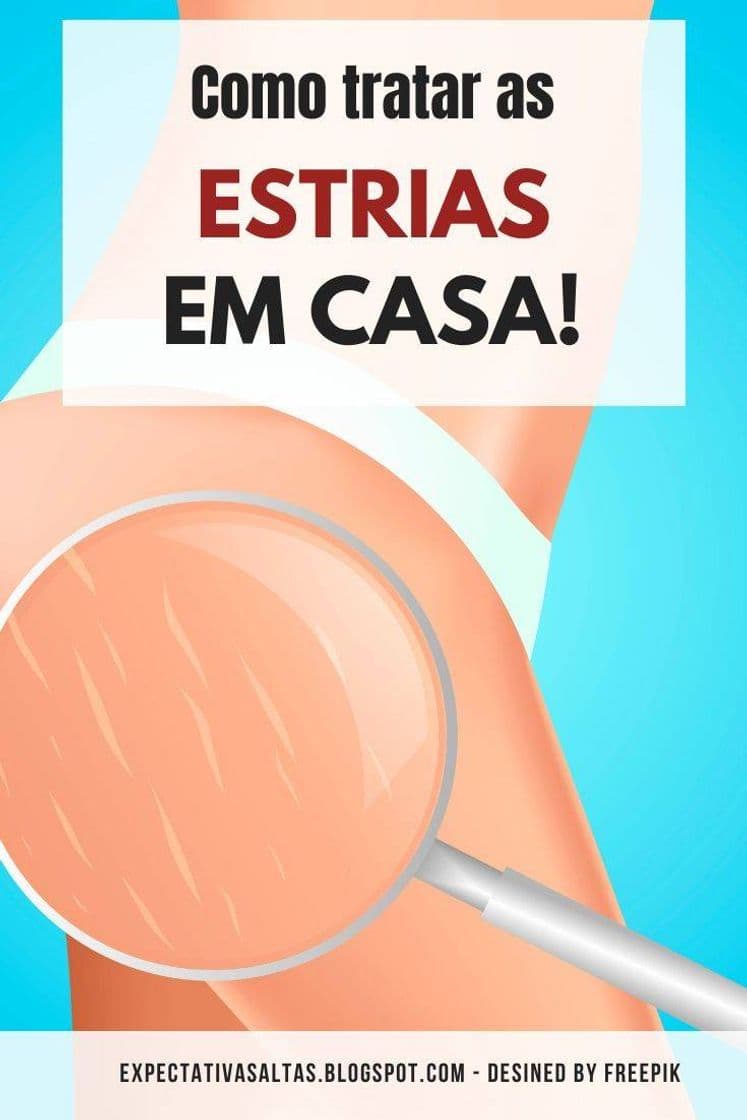 Moda Remedios naturales para estrías 😉👍