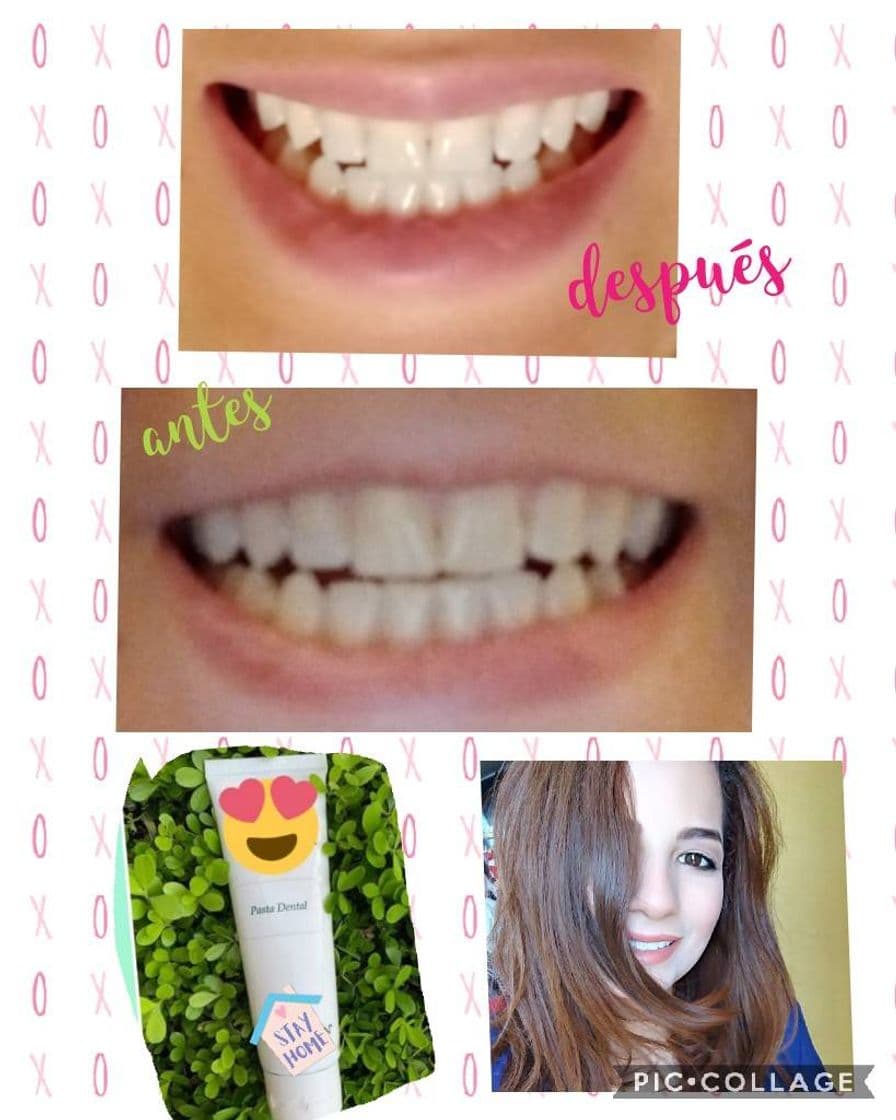 Producto Pasta de dientes desmanchadora