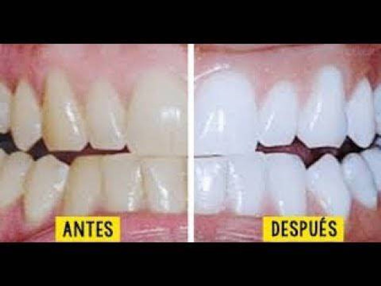 Moda receta casera para blanquear tus dientes en solo 5 minutos!!