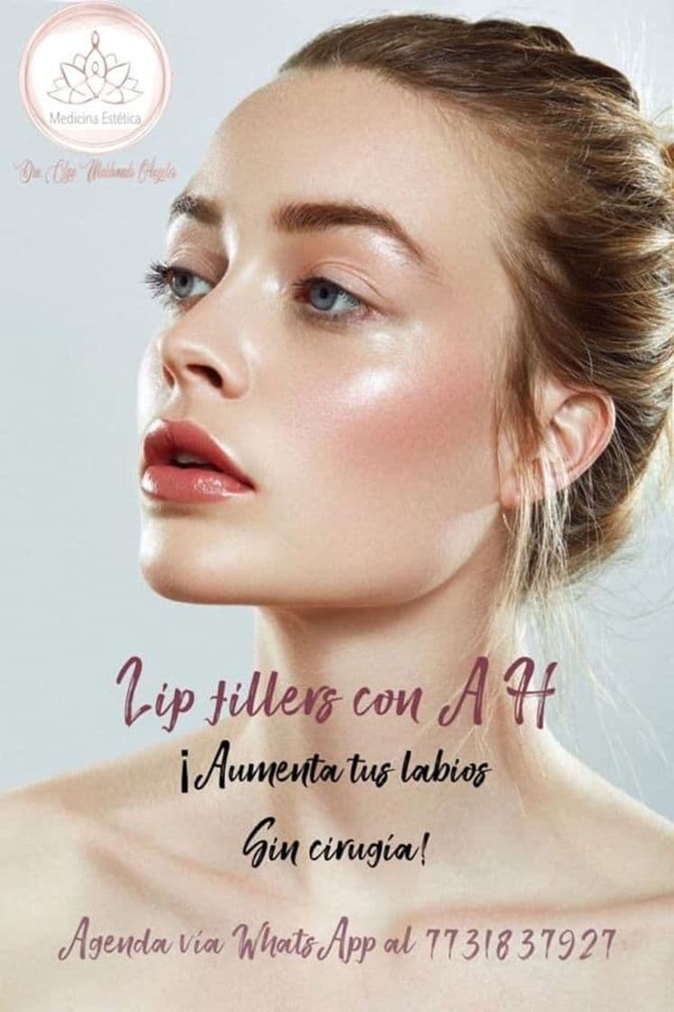 Moda Lips filler