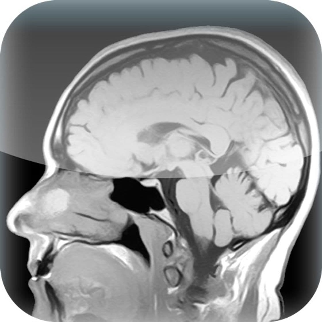 App Centricity Radiology Mobile Access (International)