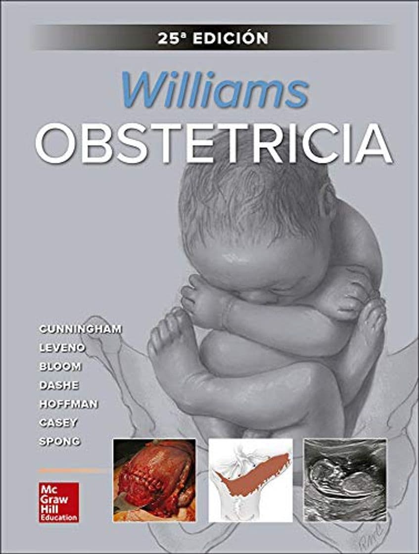 Book WILLIAMS OBSTETRICIA