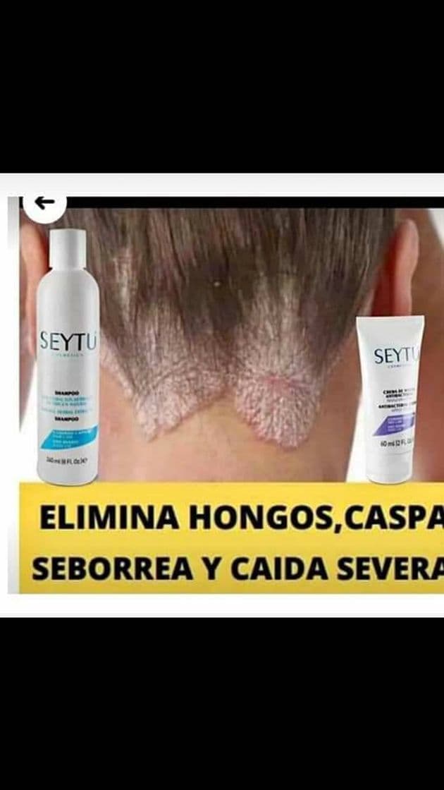 Producto Gel De EliminacióN De Cicatrices Y Marcas De Acné