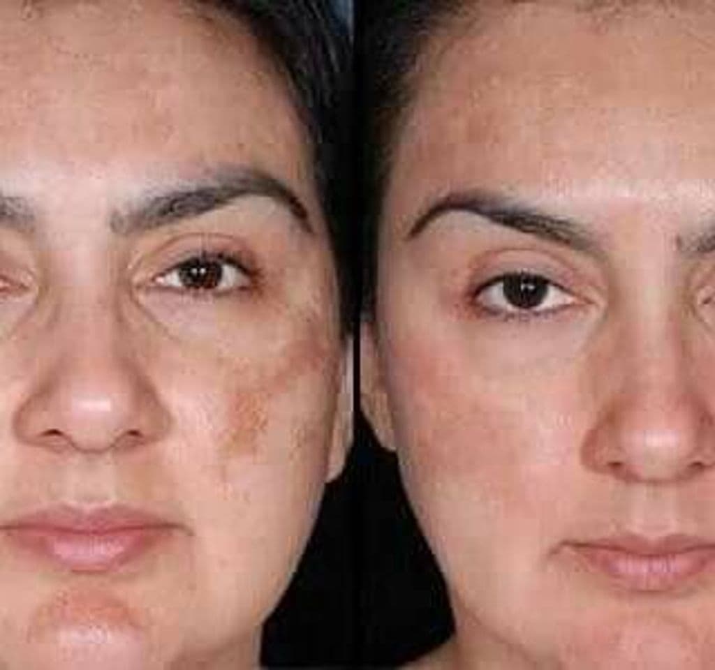 Moda Limpiador facial a base de vitamina C