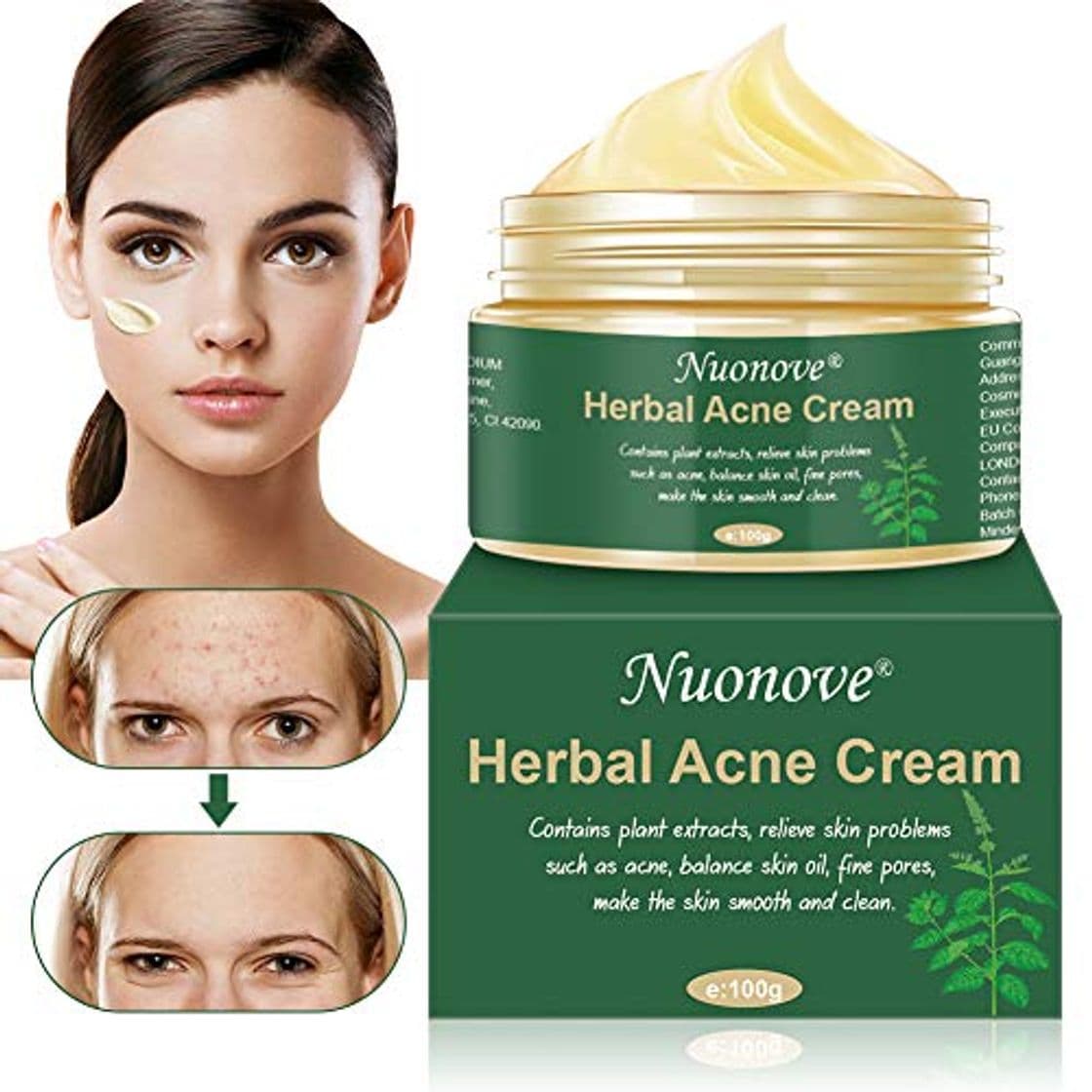 Product Crema Antiacne