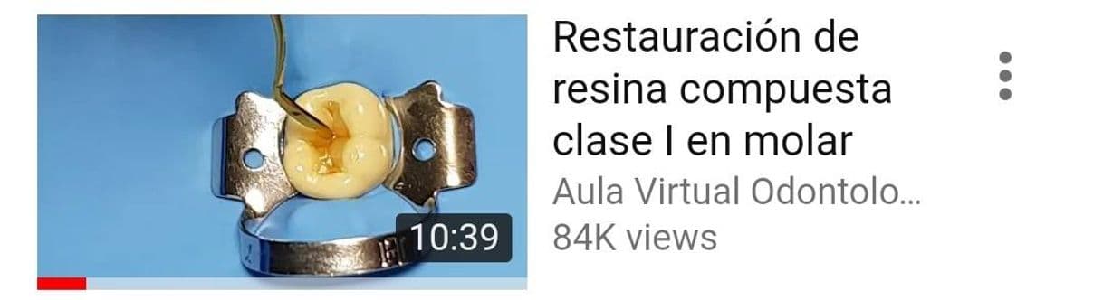 Moda Restauración de resina compuesta clase I en molar - YouTube