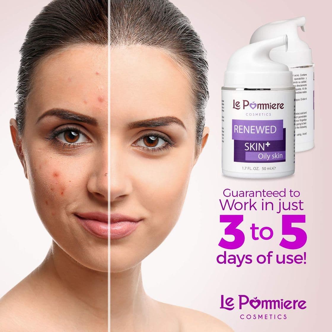 Beauty Le Pommiere Acné Gel 50ml, Ayuda a Remover Espinillas, Granos en Cara