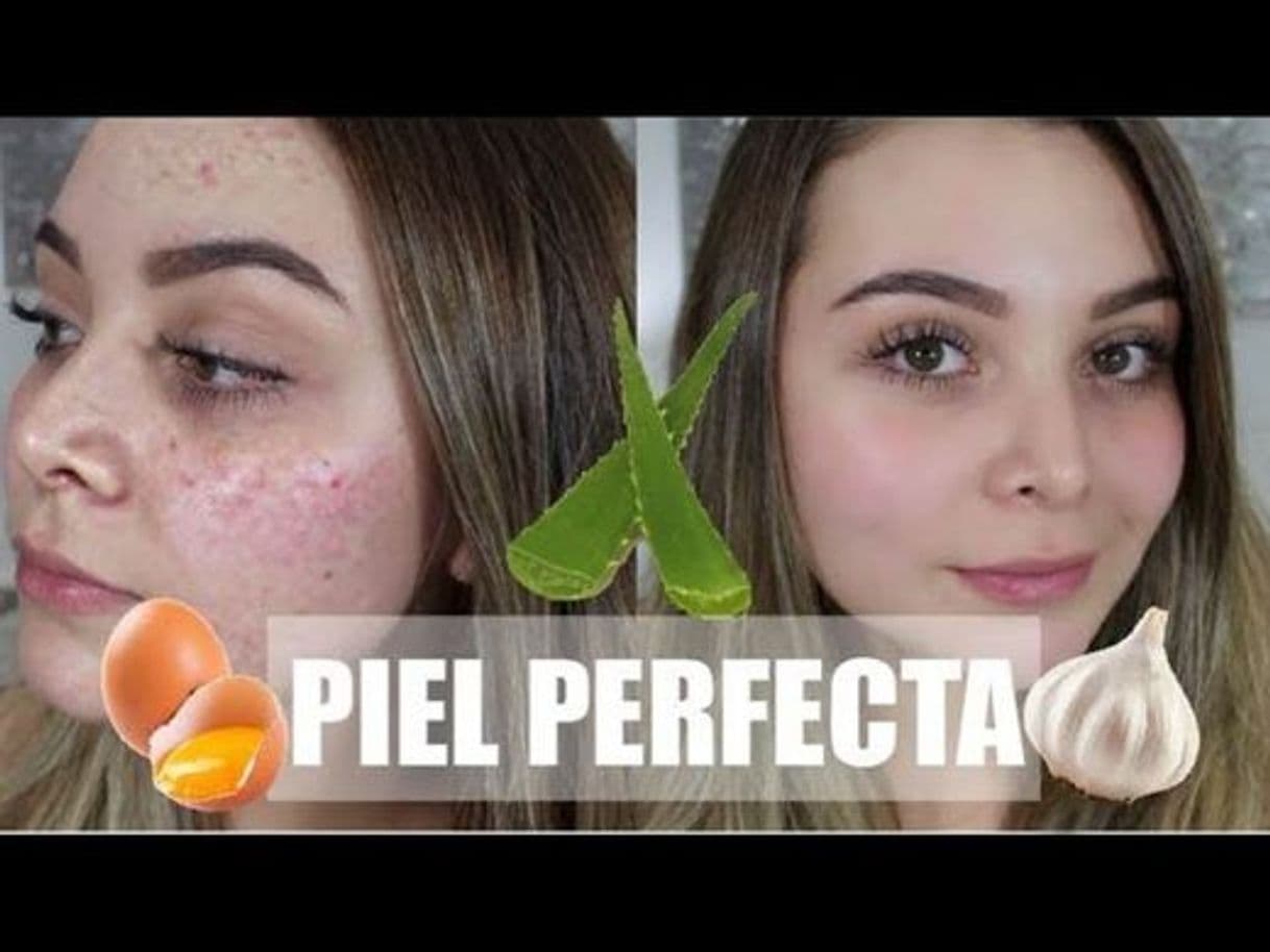 Fashion Remedios Naturales para una Piel Perfecta SIN ACNE! - YouTube