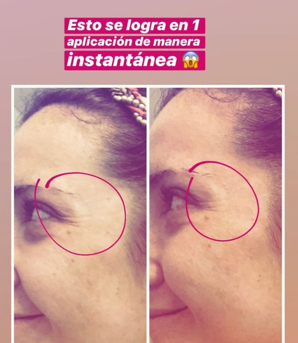 Producto Galvánica facial