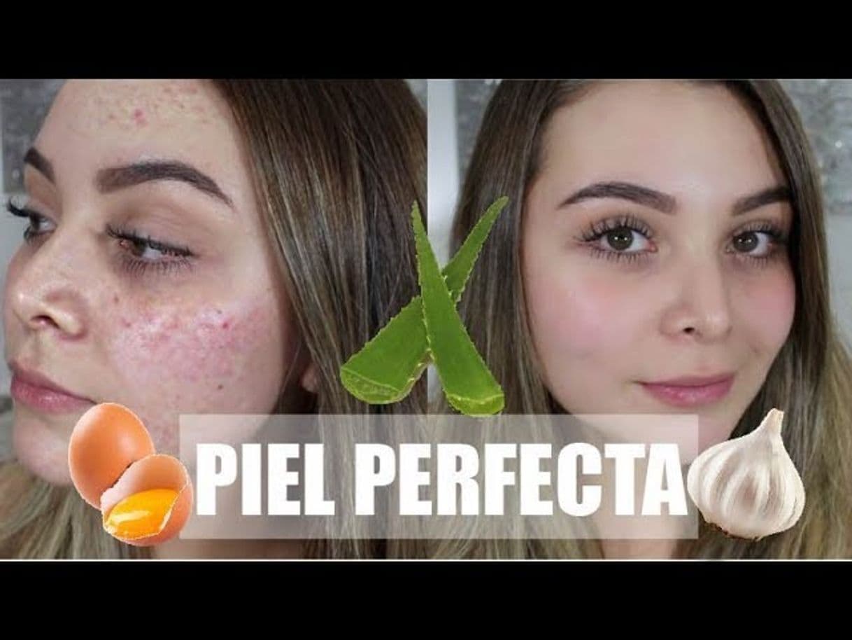 Moda Remedios Naturales para una Piel Perfecta SIN ACNE!-Maqui015