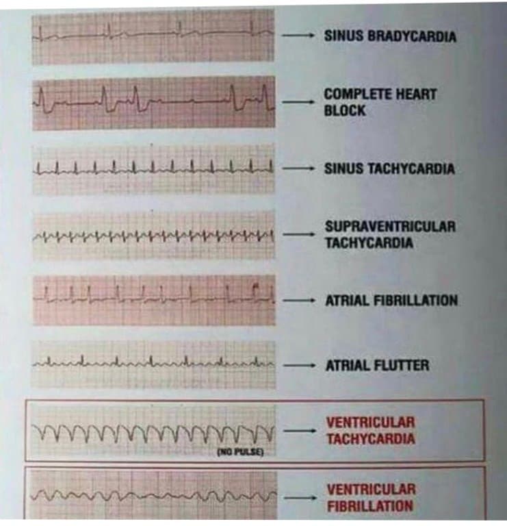 Fashion ECG 